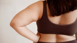 imagem de uma mulher com obesidade