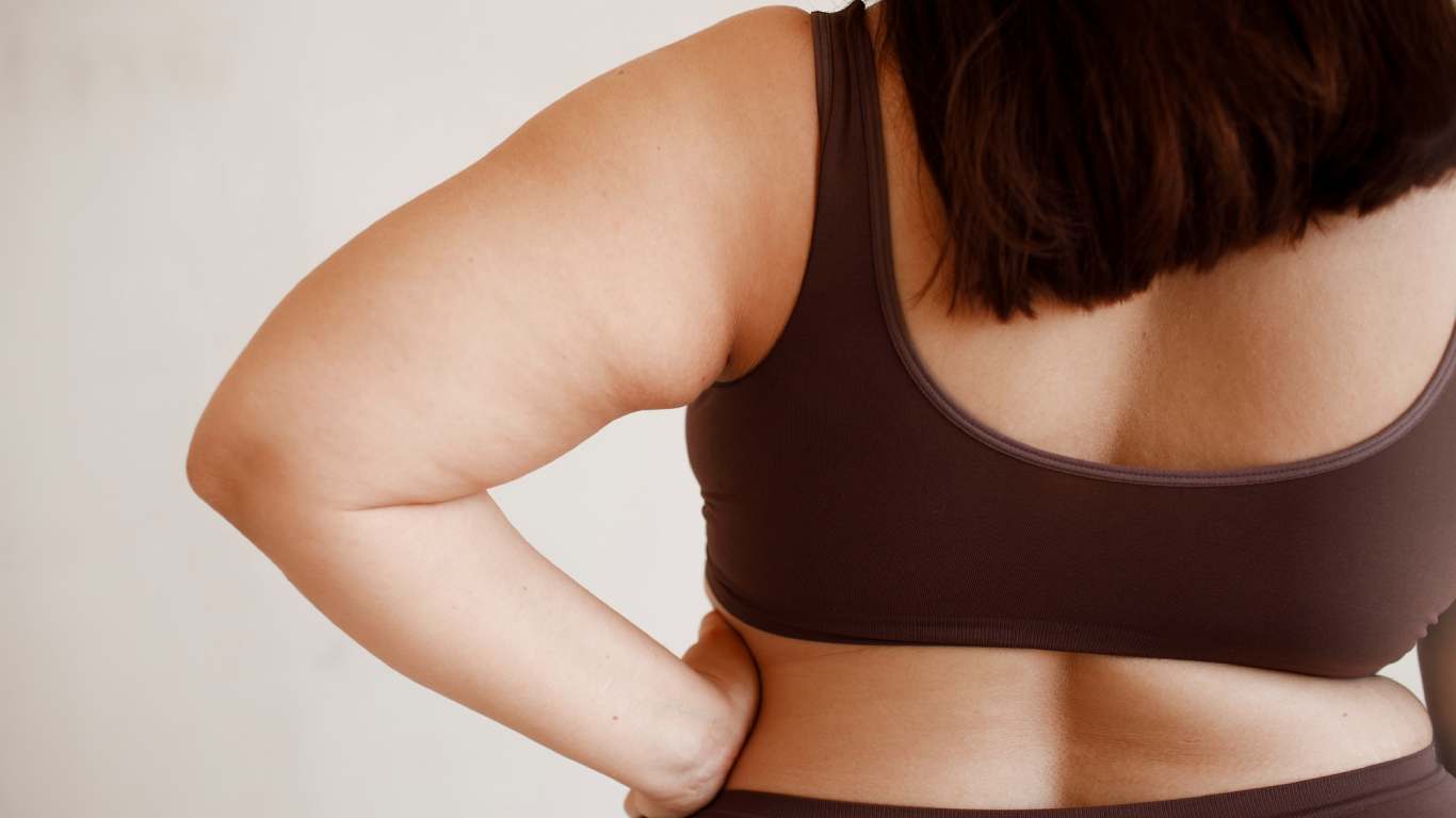 imagem de uma mulher com obesidade